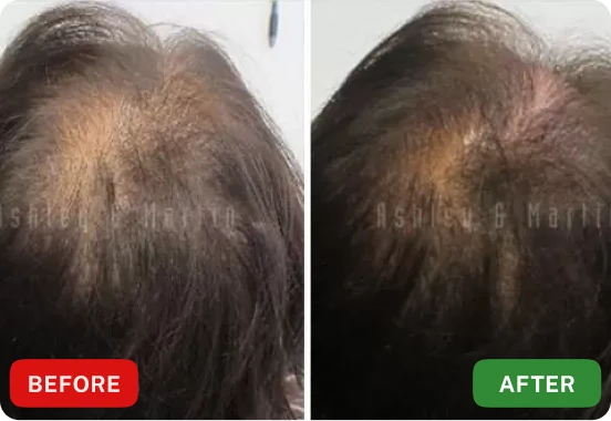 Customer shared before and after hair result