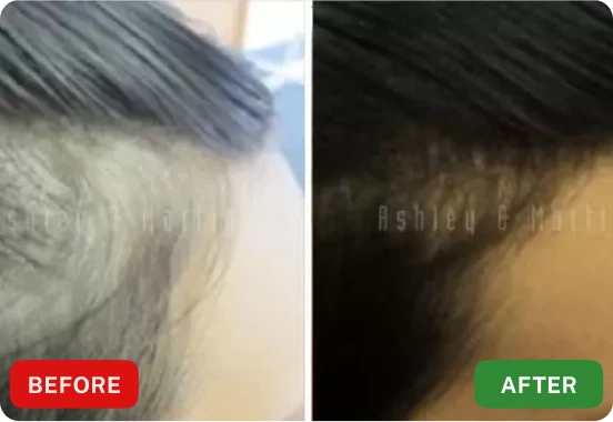 Customer shared hairline comparison